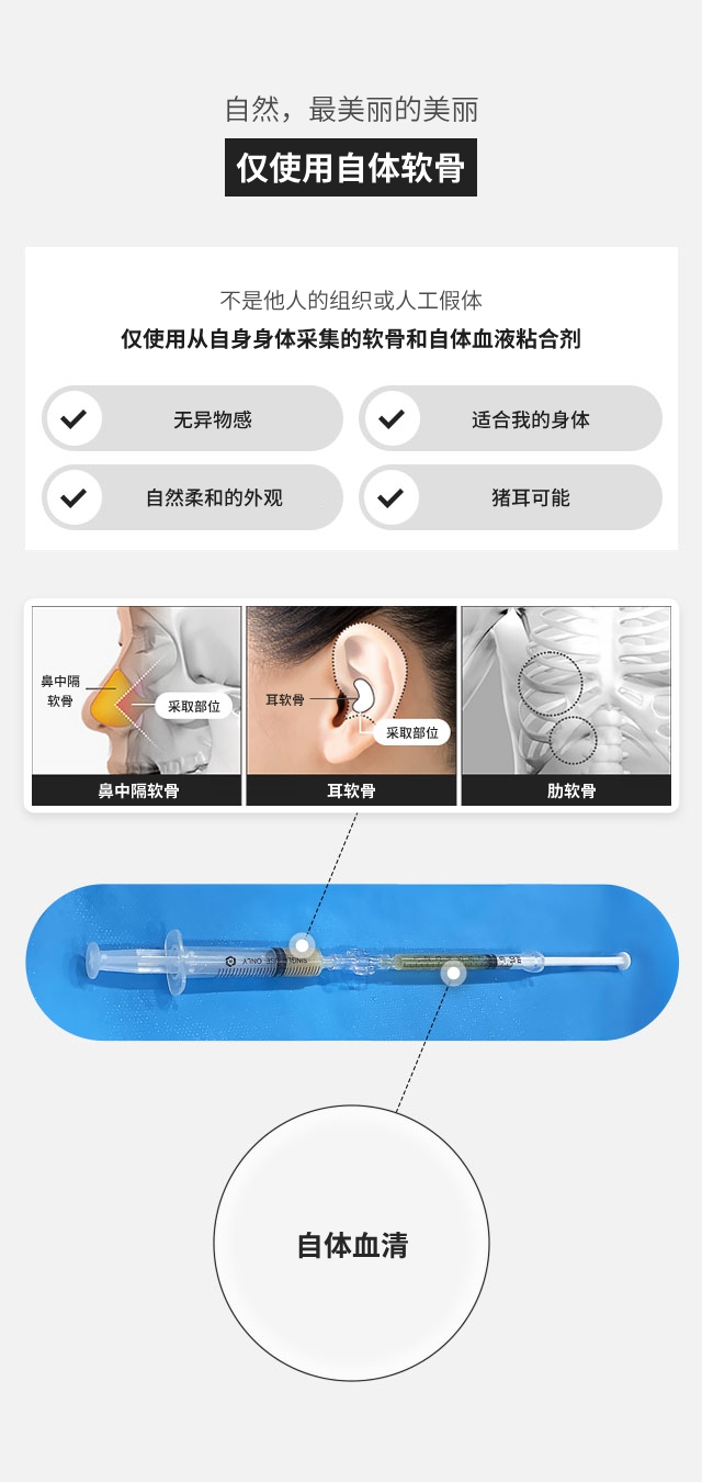 无假体软骨注射 - GNG医院