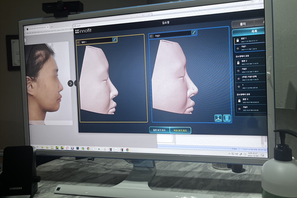 韩国GNG医院3D打印鼻建模